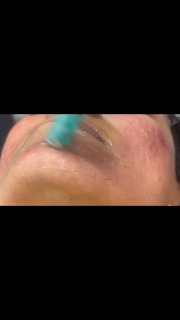 The power to reverse aging lines !