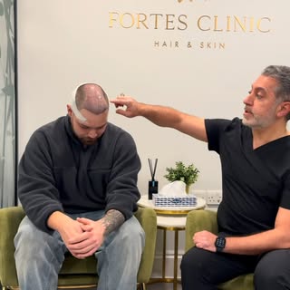 ‼️ Is hair transplant surgery very long and uncomfortable❓

A lot of patients ask how they are going