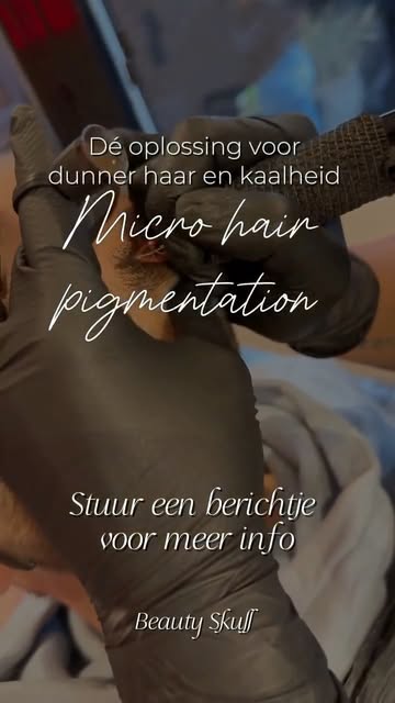 Micro Hair Pigmentatie blijft een behandeling waarvan ik het resultaat zó bijzonder vind. Door klein