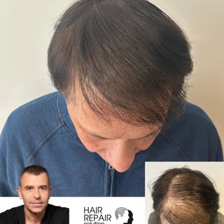 Prestations réalisées par notre équipe de formateurs 🎓 🖊 @hair_repairsolution

Hair Repair Formati