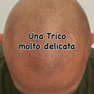 Un lavoro molto delicato svolto su un cliente con i capelli molto sottili e chiari. Qua ci vuol tant