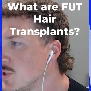 Alec finally breaks down FUE, FUT, and DHI hair transplant techniques — what they actually are, the 