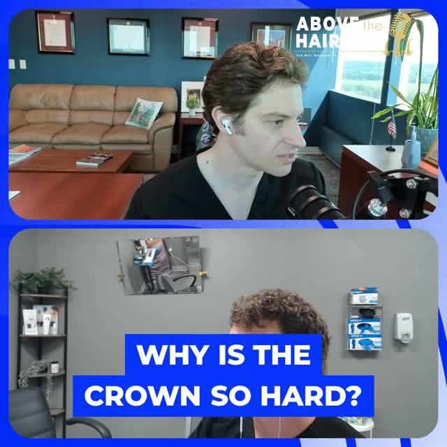 The crown area is a tricky in hair transplants 🤔

Here are five reasons:

1. The crown is in a flat