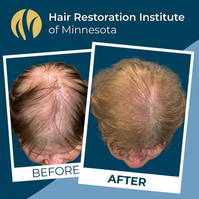 “Deb” hated her hair. Then she decided to do something about it.

During her consultation, she discu