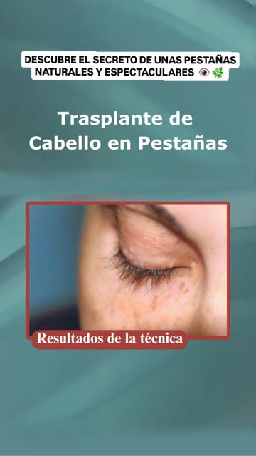 ¡Descubre el secreto de unas pestañas naturales y espectaculares! 👁 🌿 

El procedimiento es seguro