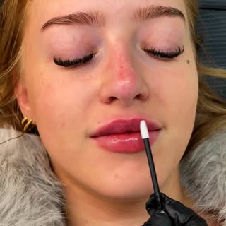 Natural but noticeable lip top up☁️✨

Visit the link in our bio or message us to book🔗

#LipFiller 