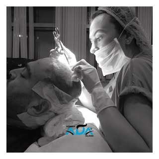 #hairtransformation #hairtransplant #hairtransplantation #doctor #hairtransplantturkey #hairtranspla
