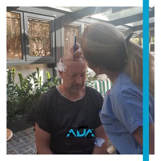 #hairtransformation #hairtransplant #hairtransplantation #doctor #hairtransplantturkey #hairtranspla