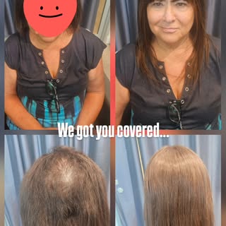 Look at that GROWTH! 🙌
While wearing our hair system, her own hair has been growing and filling in 