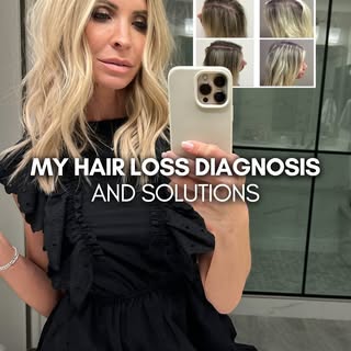 Hair loss isn’t “just hair.” 💔

For so many women it’s confidence. Identity. Femininity. It’s looki