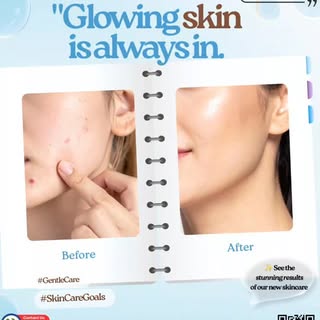 Glowing Skin, is always sin✨
#darmatologist 
#Cherush Clinic. 
@dr.krutijain.derma
