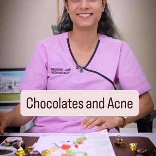 🍫 Chocolate causes acne? MYTH… but not entirely! 👀😋

Not every chocolate bar will make you break 