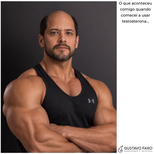 O QUE ACONTECEU COMIGO QUANDO COMECEI A USAR TESTOSTERONA… 

Calma! Obviamente essa é uma imagem ger