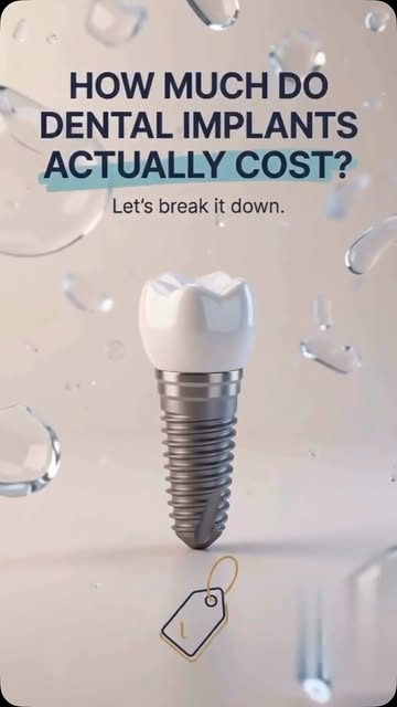 🦷 Missing tooth? Wondering about dental implant cost? 💰
The cost depends on your implant type, bon