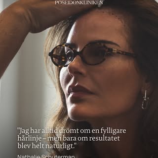 “Jag har alltid drömt om en fylligare hårlinje – men bara om resultatet blev helt naturligt.” – Nath
