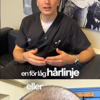 Det största misstaget många gör när de planerar en hårtransplantation är ett kortsiktigt tänk.⁠
⁠
De