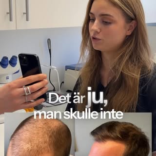 Idag kollar vi in en av våra egna patienters resultat och betygsätter.⁠
⁠
Håller ni med?⁠
⁠
#håravfa