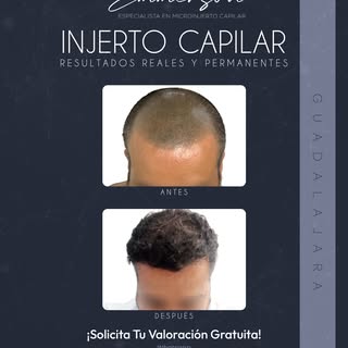 ¿Listo para recuperar tu mejor versión? 🧔✨ Con el Dr. Emmerson, obtén resultados reales, naturales 