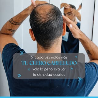 ¿Tu cabello parece tener buena cobertura hasta que se moja?

El cabello húmedo tiende a agruparse y 