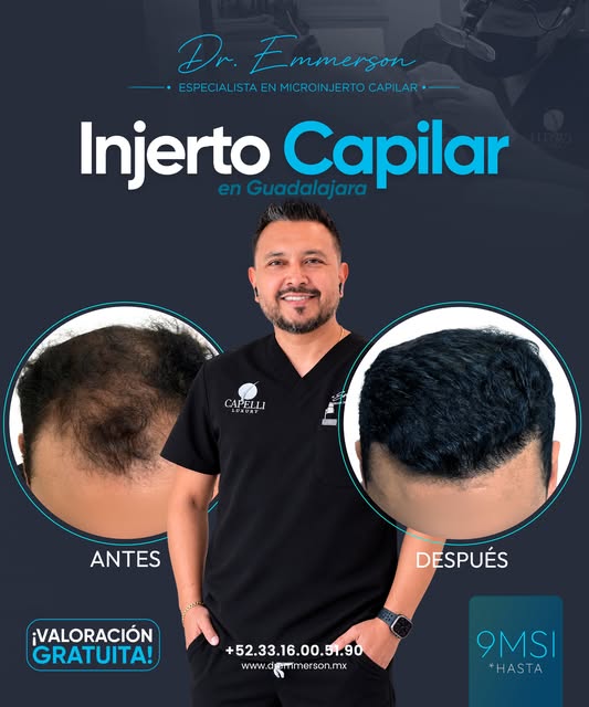 ¡Recupera la densidad de tu cabello y vuelve a lucir con total confianza! 💪✨
En manos del Dr. Emmer