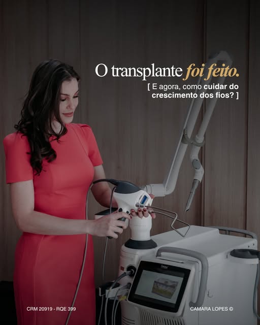 Fazer um transplante capilar é uma decisão importante, mas o cuidado com o resultado continua depois
