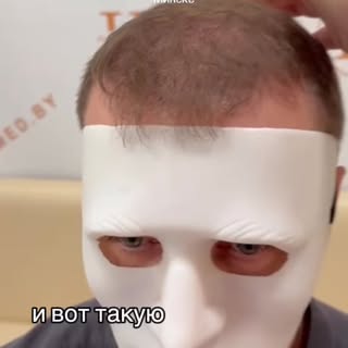HairMed.by | пересадка волос в Минске. 
Запись на консультацию по телефону +375 44 795-59-42 
Стоимо
