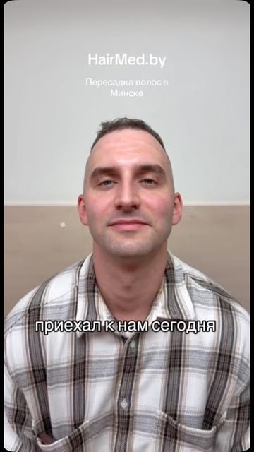 HairMed.by | пересадка волос в Минске. 
Запись на консультацию по телефону +375 44 795-59-42 
Стоимо