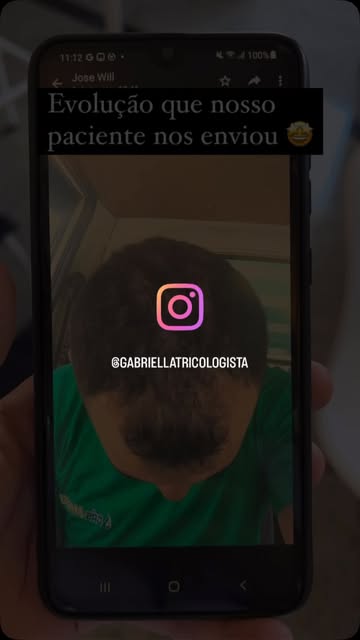 Paciente ainda em tratamento inicial mas já nos enviou sua evolução 🤩🤩