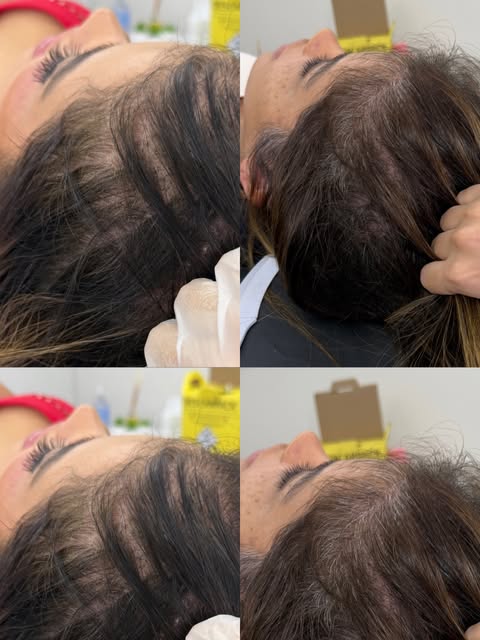 Fazendo muito cabelo nascer por aqui !

📍Visite nossa clínica:
Rua Emiliano Perneta, 725, Sl. 1202 