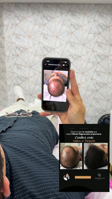 Evolução maravilhosa com o método regenerador !!!

📍Visite nossa clínica:
Rua Emiliano Perneta, 725