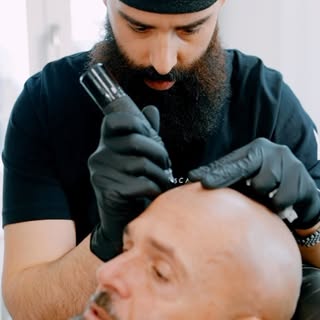Step into a world of confidence and transformation with Scalp Micropigmentation. This technique rede