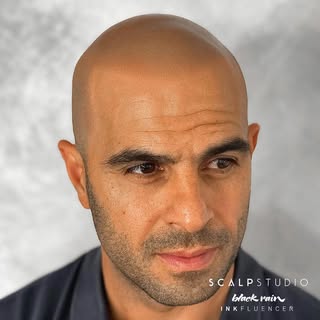 SOMETIMES LESS IS MORE

Broken Hairline - Natural Transitions

In most cases, less is more. Many cli