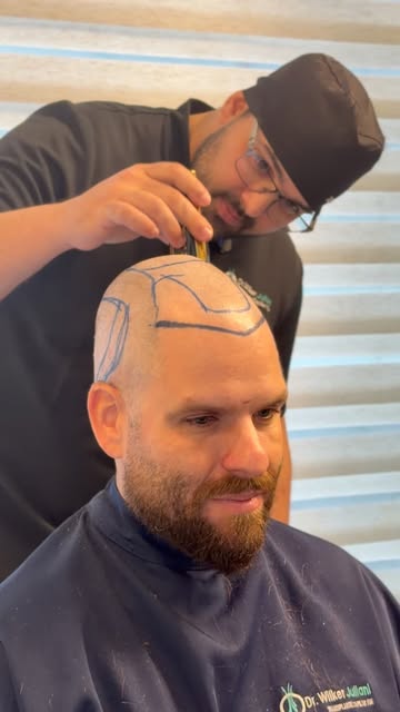 Semana passada realizamos a cirurgia do @gustavomonteiro_ , quero trazer pra vocês cada etapa desse 