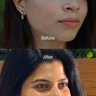 When skincare is backed by science, confidence follows.

Led by Dr. Abirami, B16 is Coimbatore's lar