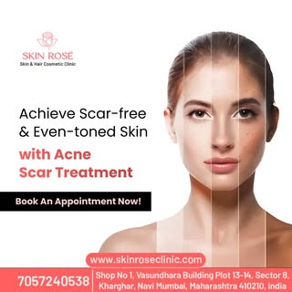 ✨🌸 Achieve Scar-Free & Even-Toned Skin! 🌸✨

Say goodbye to acne scars with our advanced acne scar 
