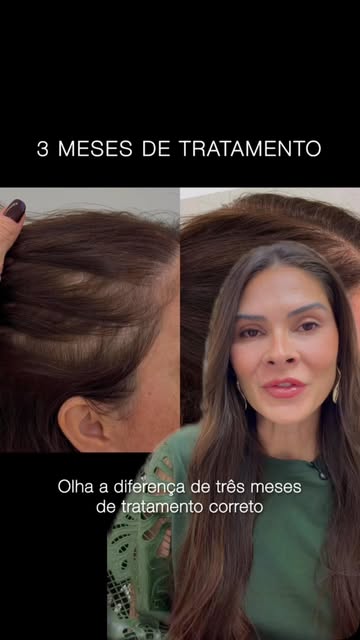 Essa é a diferença de 3 meses de tratamento correto — feito com diagnóstico, acompanhamento e o prot