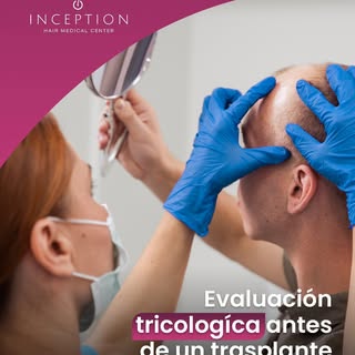 Antes de cualquier trasplante capilar, es fundamental analizar a fondo la salud de tu cuero cabellud