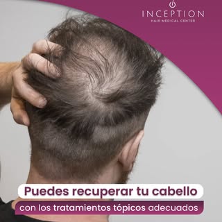 ¿Notas que tu cabello está más delgado o se cae con facilidad?
Tranquilo, no estás solo.

👨‍⚕️ El p