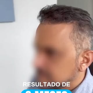 Com 8 meses, o resultado já permite uma leitura mais clara da densidade e do desenho construído ao l