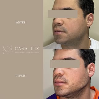 Uma mandíbula máscula é a marca de uma face masculina. Transmite força, poder e autoridade.

Neste c