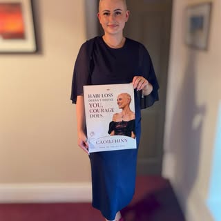 Off to support my fellow baldie and @thehairlosshaven bestie @caoilfhinn_nichoiligh @westmeathrose a