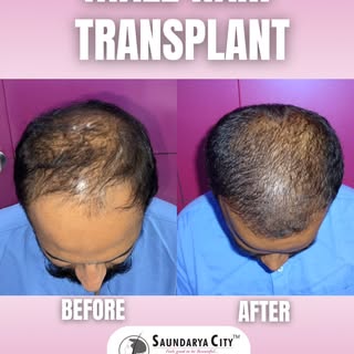 There’s nothing more rewarding than seeing our patients regain not just their hair — but their confi