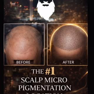 San Antonio’s #1 Scalp Micro Pigmentation Studio ⚡️

Still hiding thinning hair under hats? Not anym
