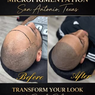Transform your look. Rebuild your confidence.

At ScalpSA, we specialize in elite scalp micro pigmen