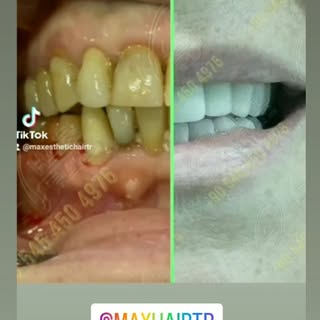 Excellent Experiences by Max Health Group
🌐 maxaesthetics.net
🌐 maxhairtrans.com
📞+90 545 450 497