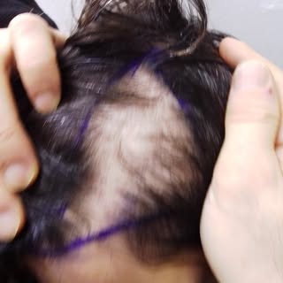 Every transformation begins with meticulous planning and expert care. At Max Aesthetics & Hair, we a