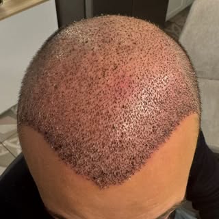 Embarking on a journey with Max Aesthetics & Hair means experiencing meticulous care and attention t