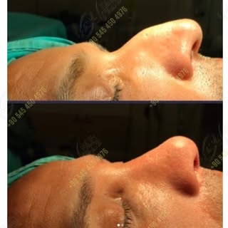 Focused care and precision define every step of your journey with Max Aesthetics & Hair. We are comm