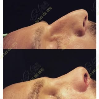 Subtle refinements can make a profound difference. At Max Aesthetics & Hair, we focus on meticulous 