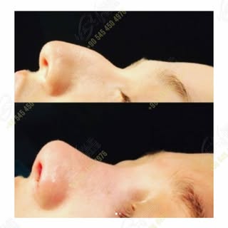 Witness the subtle artistry and meticulous care that defines every aesthetic journey at Max Aestheti